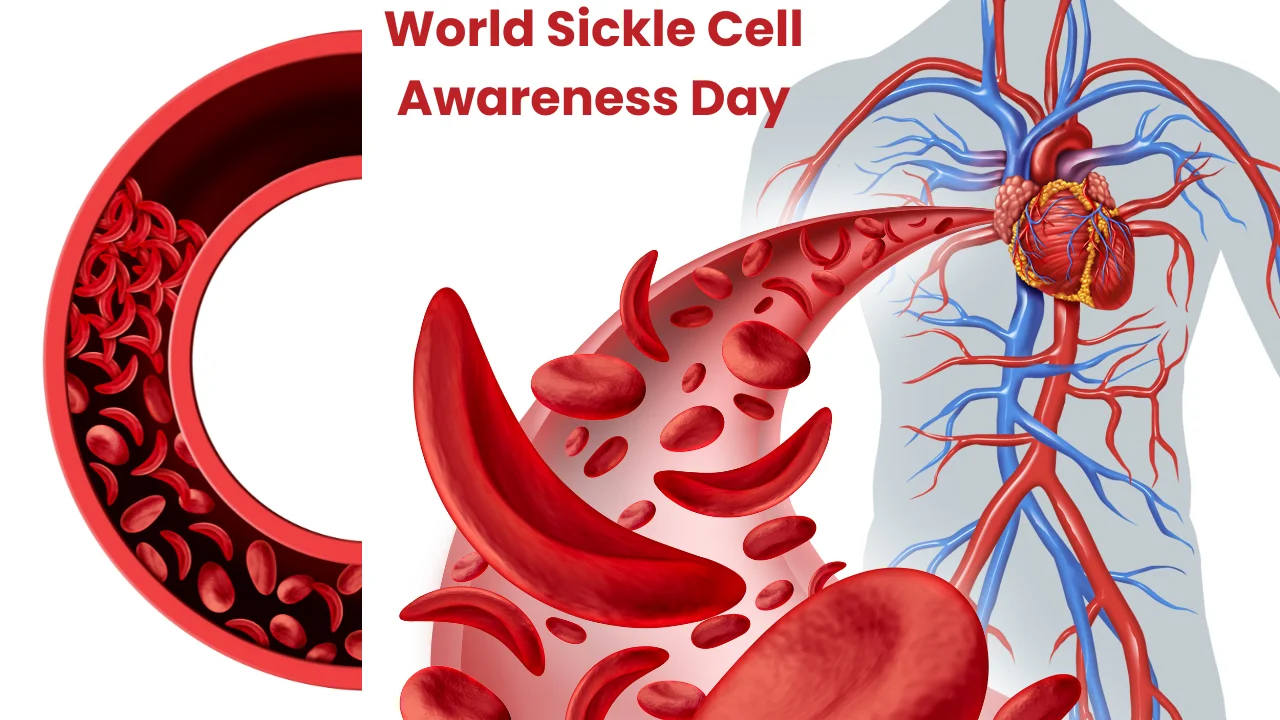 World Sickle Cell Awareness Day 2024 (19th June)