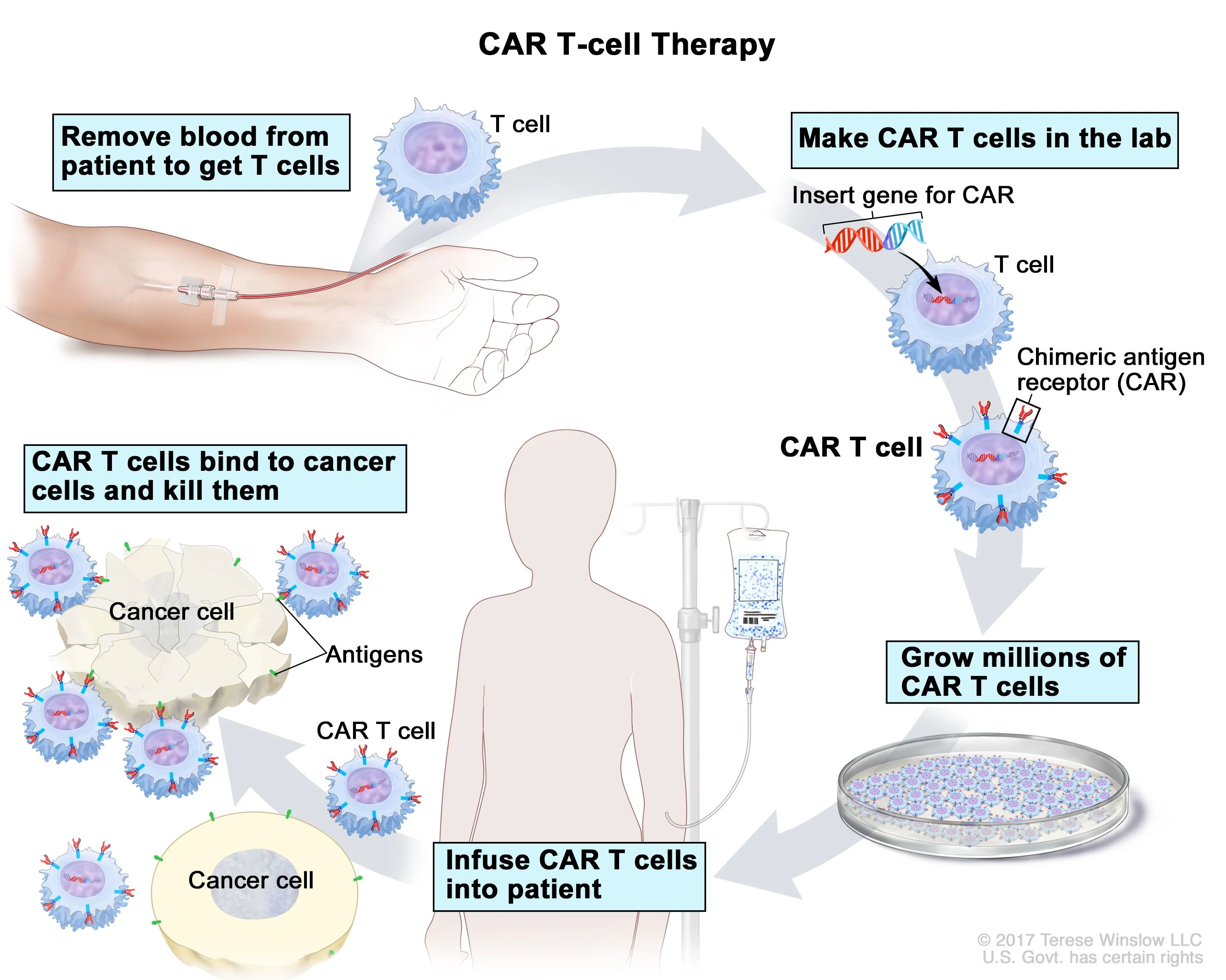 Process of CAR-T Cell Therapy